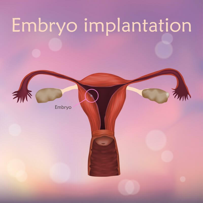 Verschachtelung oder Implantation von Embryonen