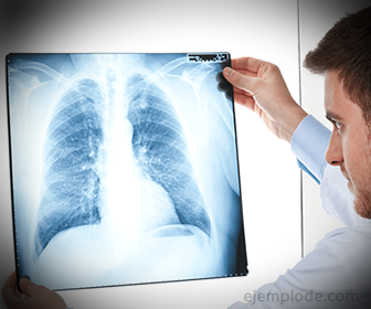 Radiografia, produto de raios-X