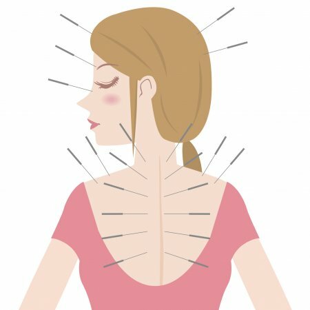 Pomen vadbe akupunkture