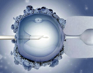 Icsi assisted reproduction