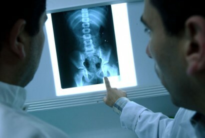 Röntgenové lúče